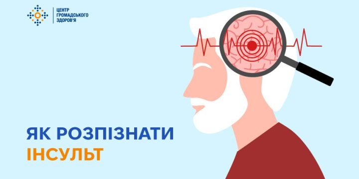 Як розпізнати інсульт